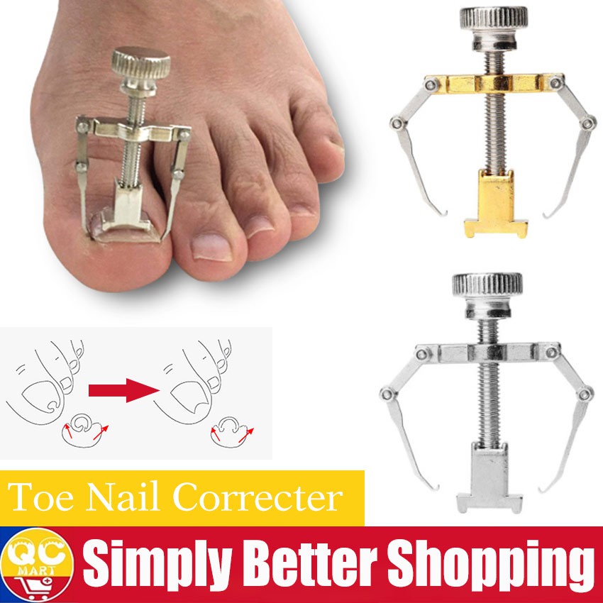 1PC Ingrown Toe Nail Correction Tool Fixer Recover Toe Paronychia Nail