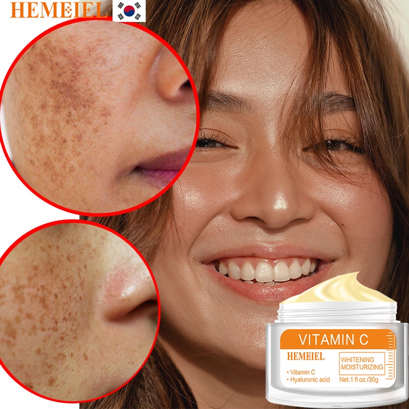 HEMEIEL Melasma Cream Super Collagen Dark Spot Remover Melasma Cream