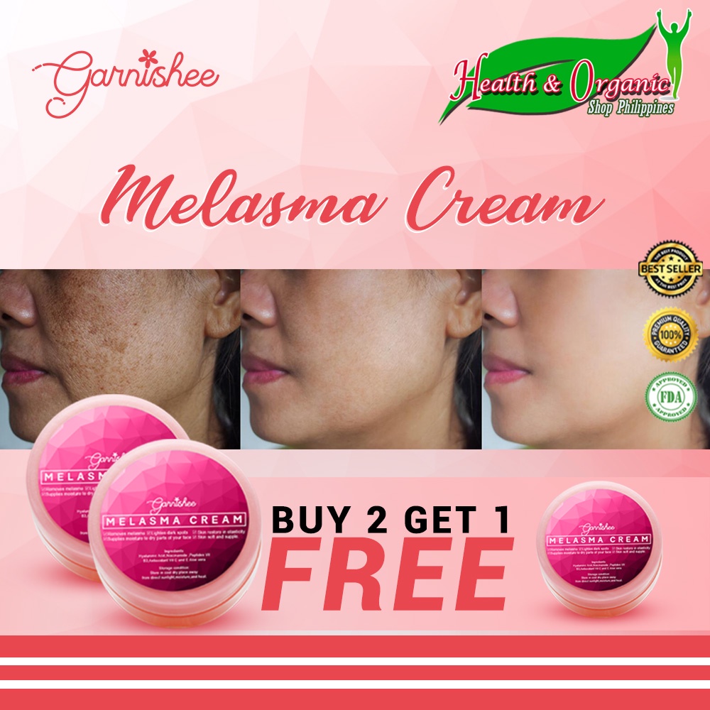 Buy 2 Get 1 Free Of Garnishee Melasma Cream 100 Effective Melasma