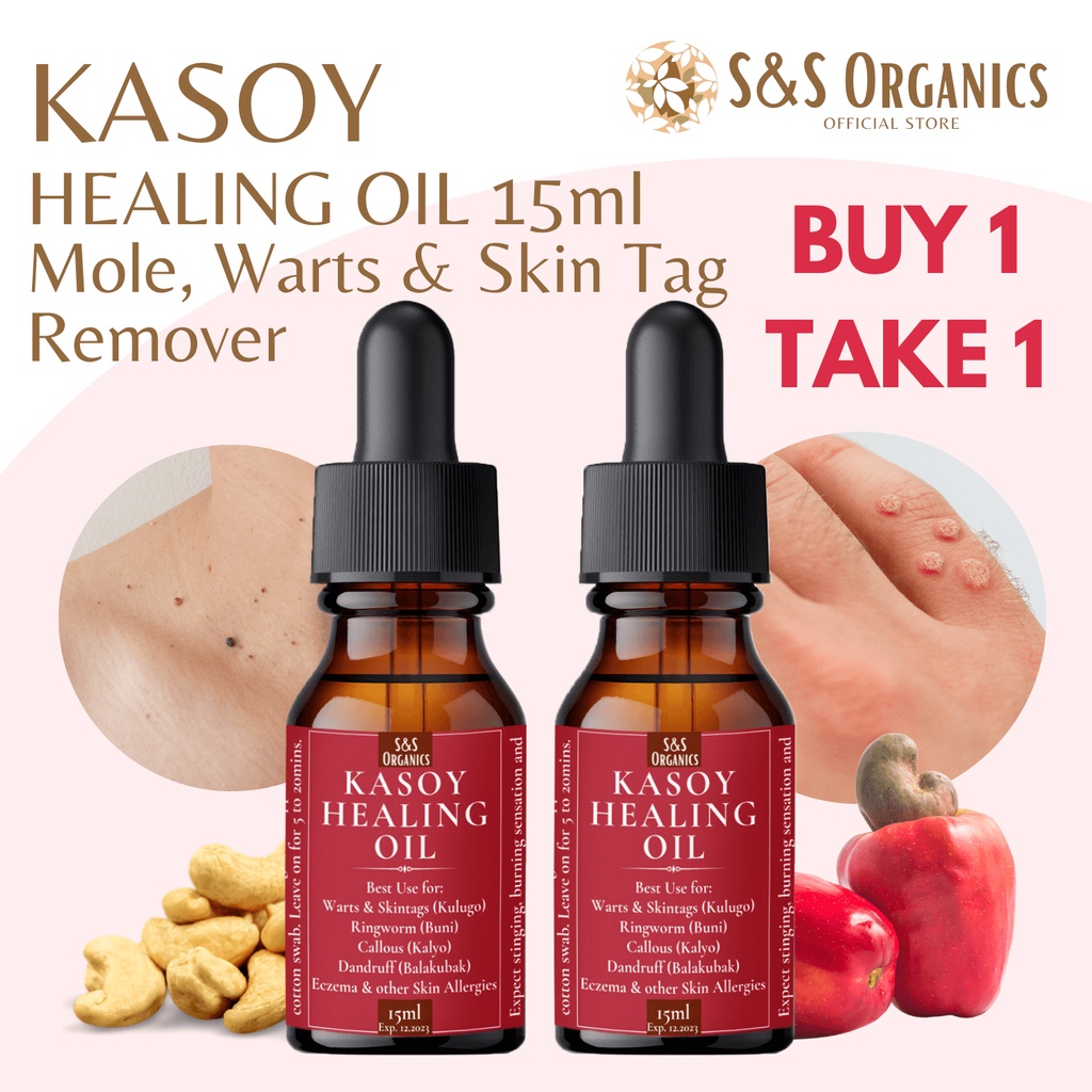 Warts Remover Original Pure Kasoy Oil For Mole Skin Tag Removal