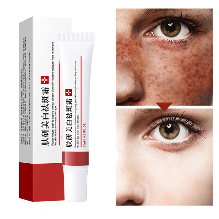 Effective Whitening Freckle Cream Remove Melasma Acne Dark Spot Melanin