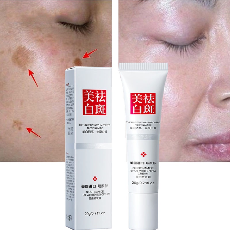 Korea Original 20g Niacinamide Freckles Remover Facial Cream Melasma