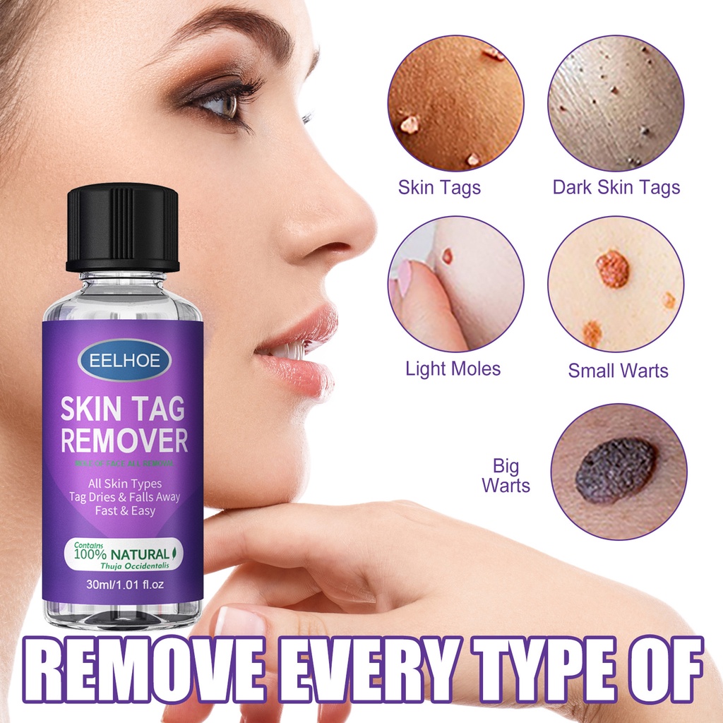 EELHOE Skin Tag Remover Fast Removal Wart Moles Acne Treatment Anti