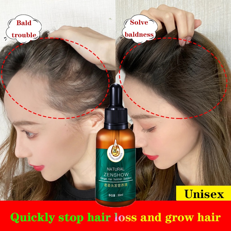 Hair Growth Serum Ginger Hair Treatment Essence Anti Hair Loss Spray