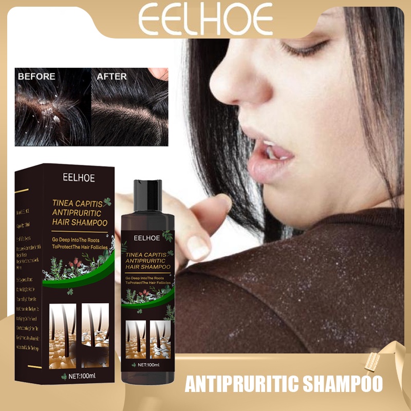 Eelhoe Tinea Capitis Antipruritic Hair Shampoo Tinea Scalp Anti Itching