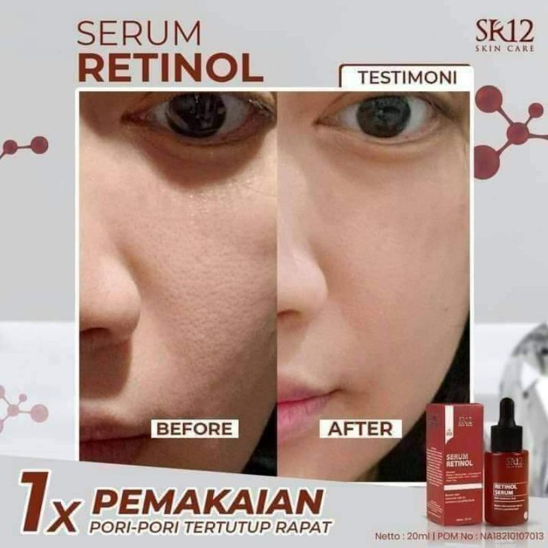 Retinol Serum By SR12 Shopee Philippines