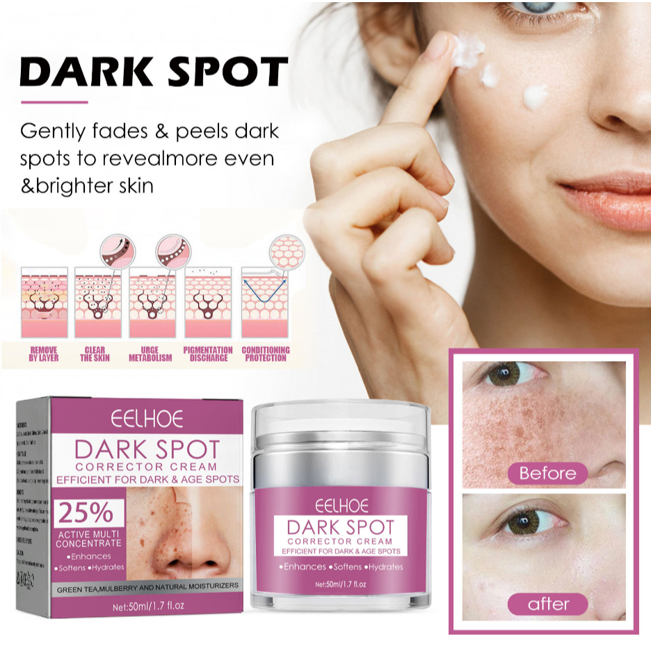 Eelhoe Dark Spot Corrector Cream Efficient For Dark Age Spots Whitening