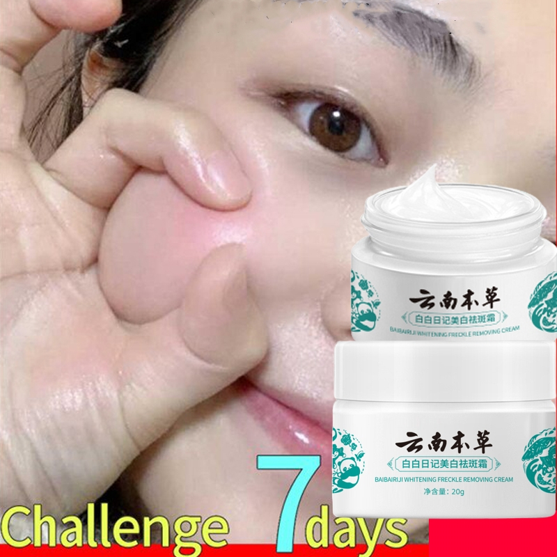 Japanese Melasma Pekas Remover Yunnan Herbal Cream White Spot Cream G