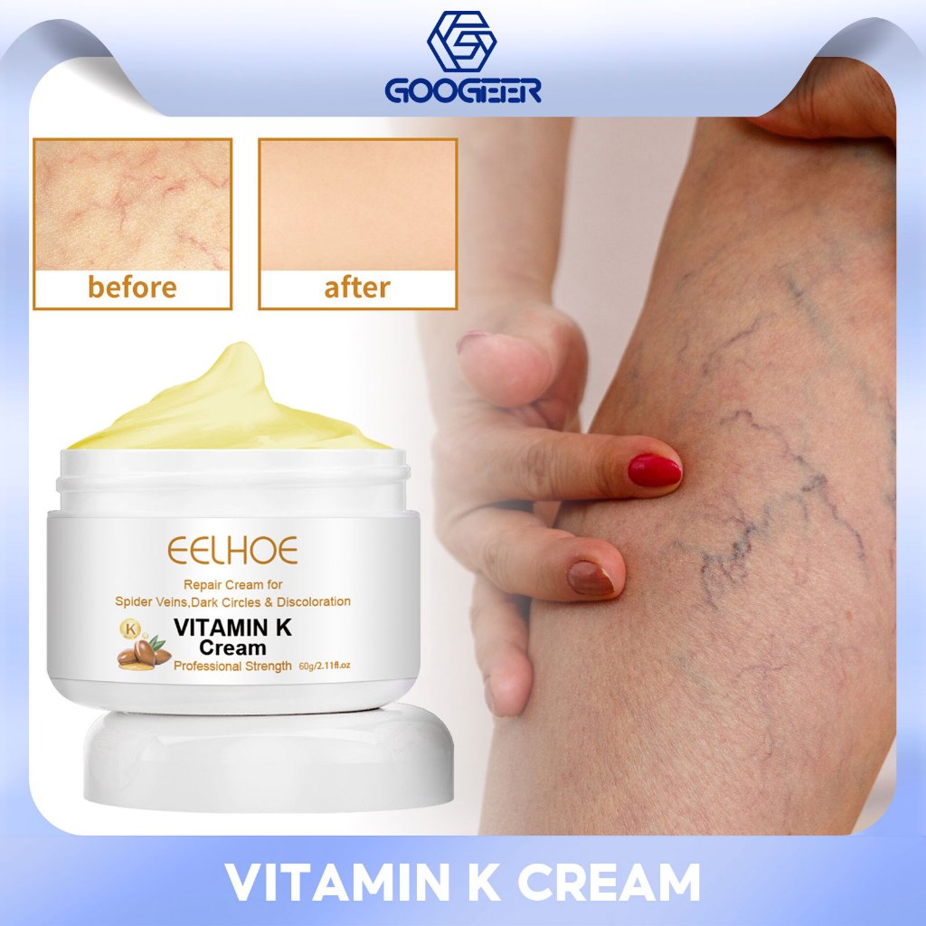 EELHOE Varicose Vein Treatment Cream Relieve Legs Tired Dilated