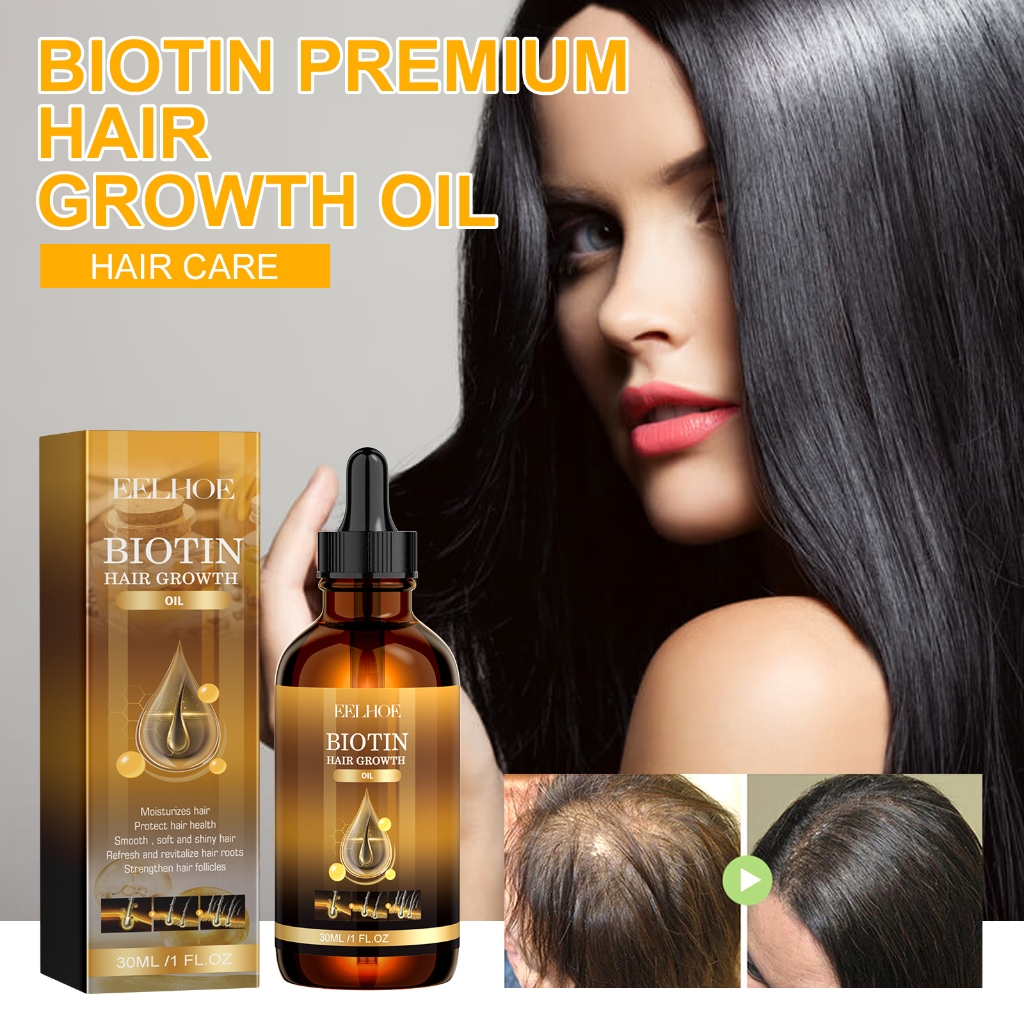 Eelhoe Biotin Hair Growth Shampoo Anti Hair L Oss Repair Damaged Frizz