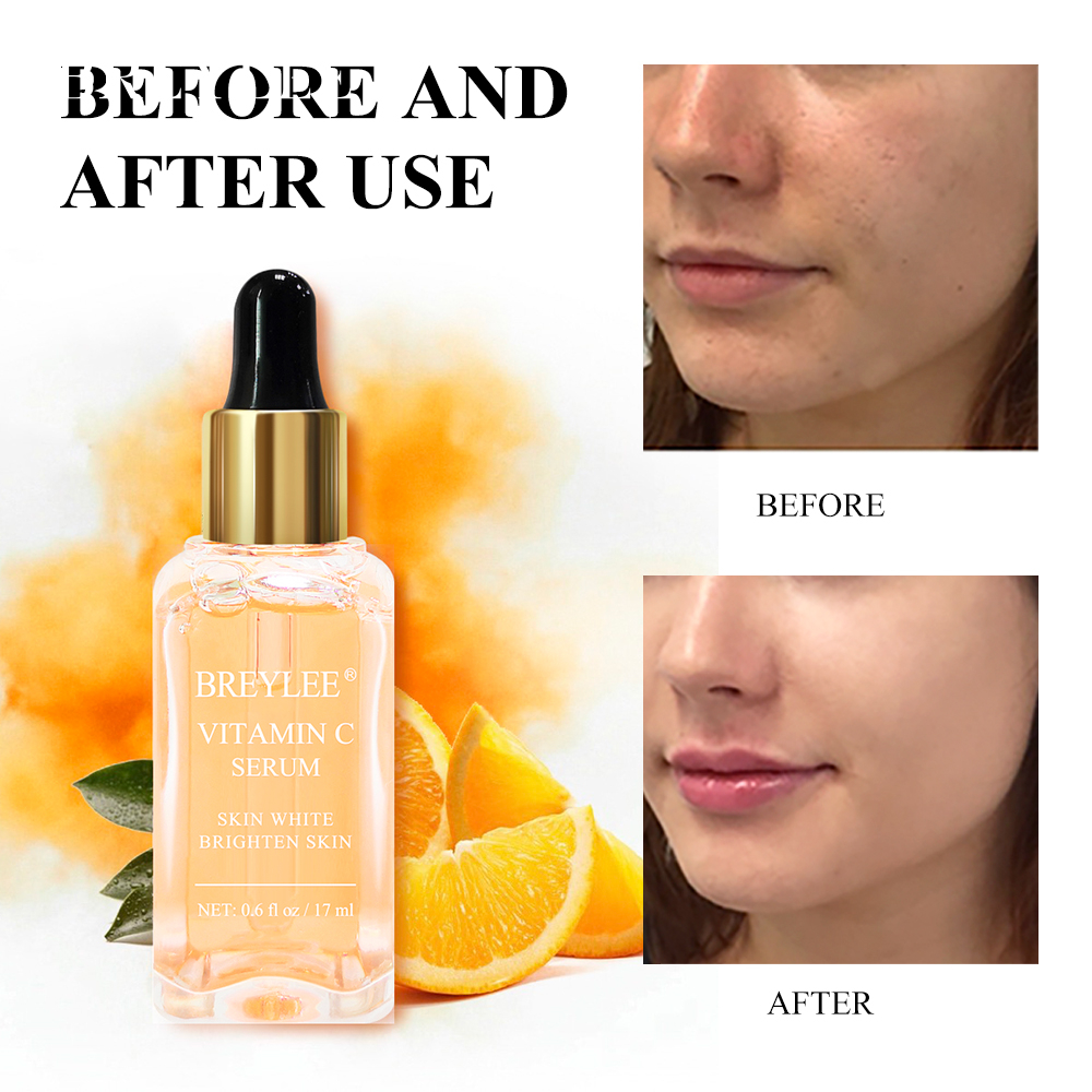 BREYLEE Vitamin C Whitening Serum VC Whitening Essence Serum Face Serum