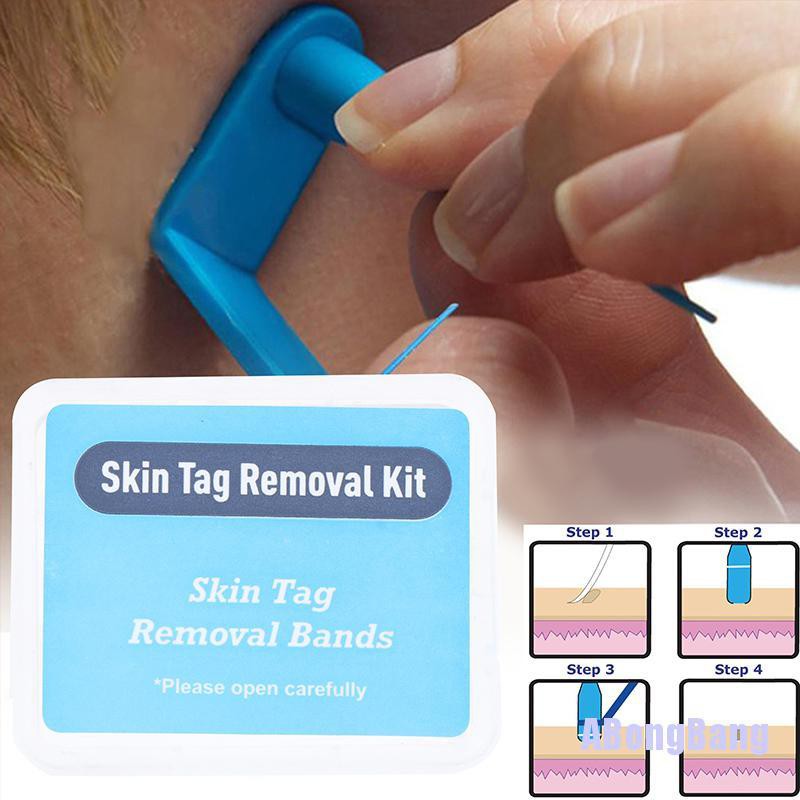 Abongbang Pcs Skin Tag Removal Rubber Bands Micro Band Non Toxic