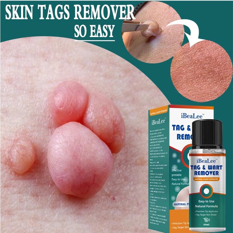 Skin Tag Remover Cream Painless Mole Skin Dark Spot Warts Remover Serum