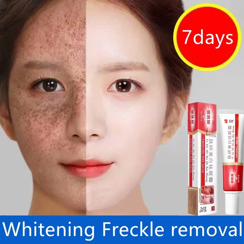 Effective Freckle Cream Remove Dark Witening Fade Acne Scars Melasma