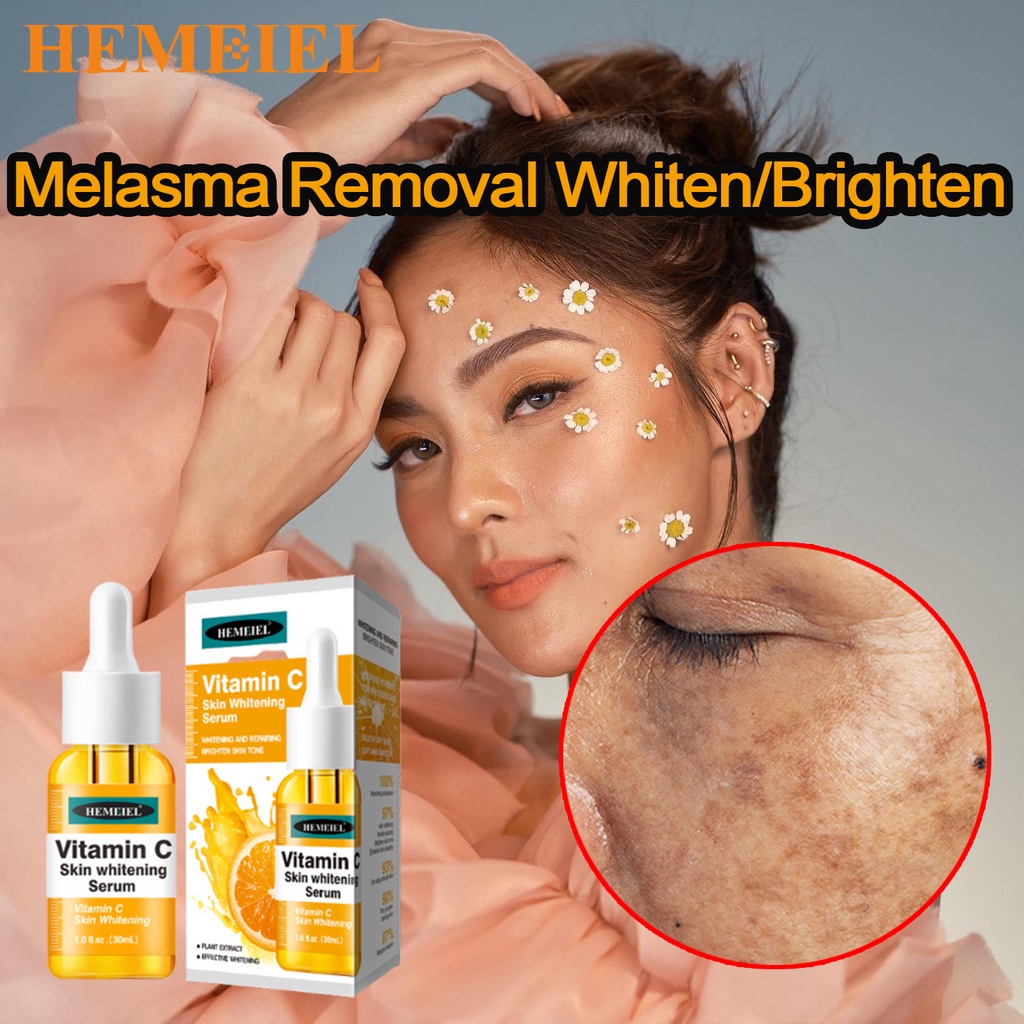 Hemeiel Vitamin C Whitening Serum For Face Pekas Melasma Remover