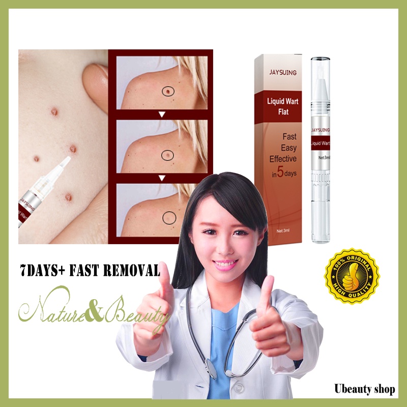 Jaysuing Wart Remover Pen Treatment Papillomas Acuminate Armpit Flat