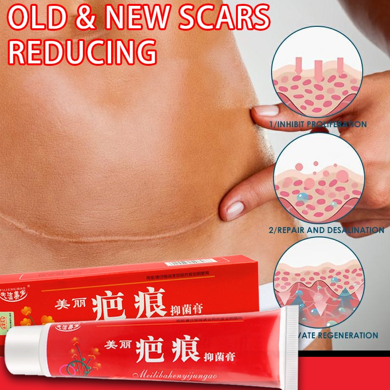 Scar Removal Cream Peklat Remover Acne Scar Remover Stretch Mark