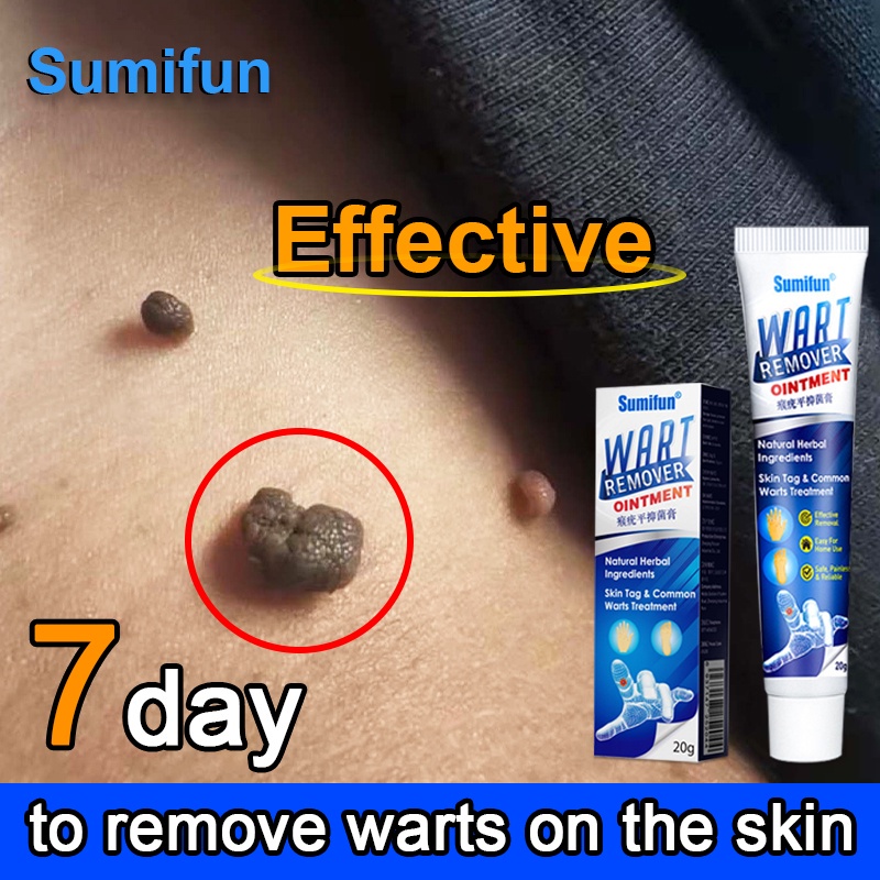 SUMIFUN Warts Remover Original Cream Painless Wart Remover Ointment 20g