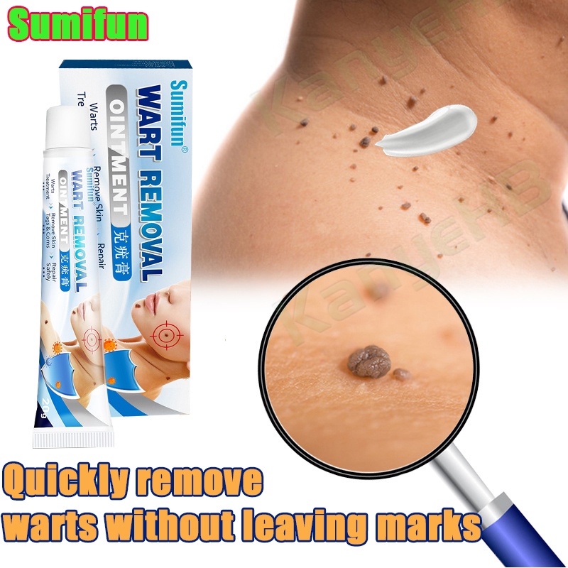 SUMIFUN Wart Remover Original Cream Wart Removal Ointment Skin Tag