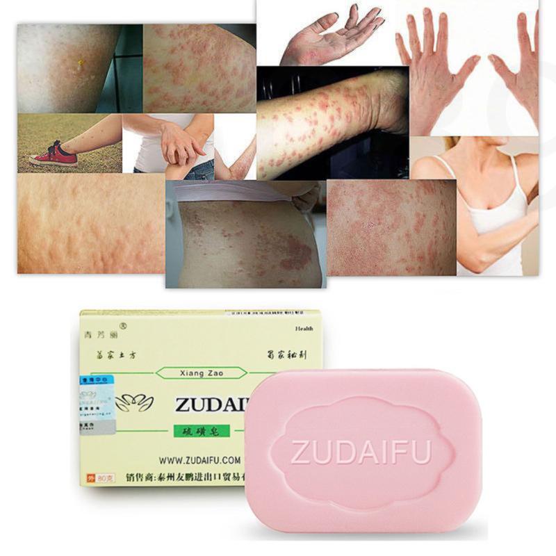 K Zudaifu Sulfur Soap Anti Fungus Acne Psoriasis Seborrhea Eczema