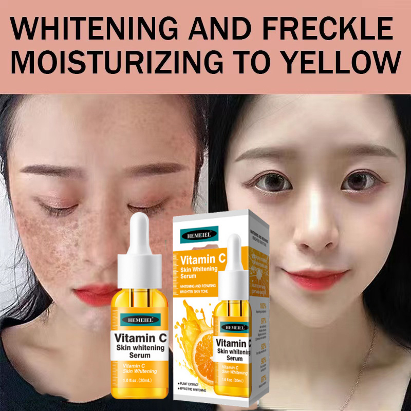 HEMEIEL Vitamin C Serum Time Capsule Serum Melasma Cream Pekas Remover