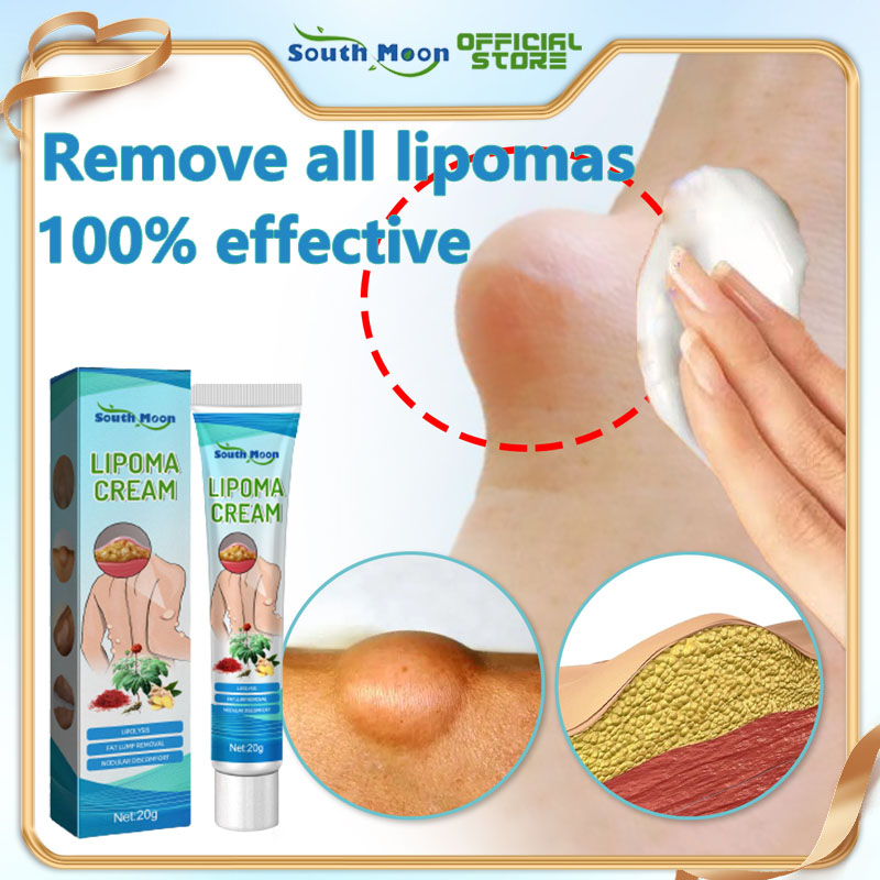 South Moon Lipoma Cream Original Removal Japan Lipoma Removal Cream