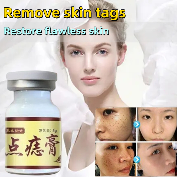 Concentrated Potent Skin Tag Removal Cream Body Warts Cream Spot Mole