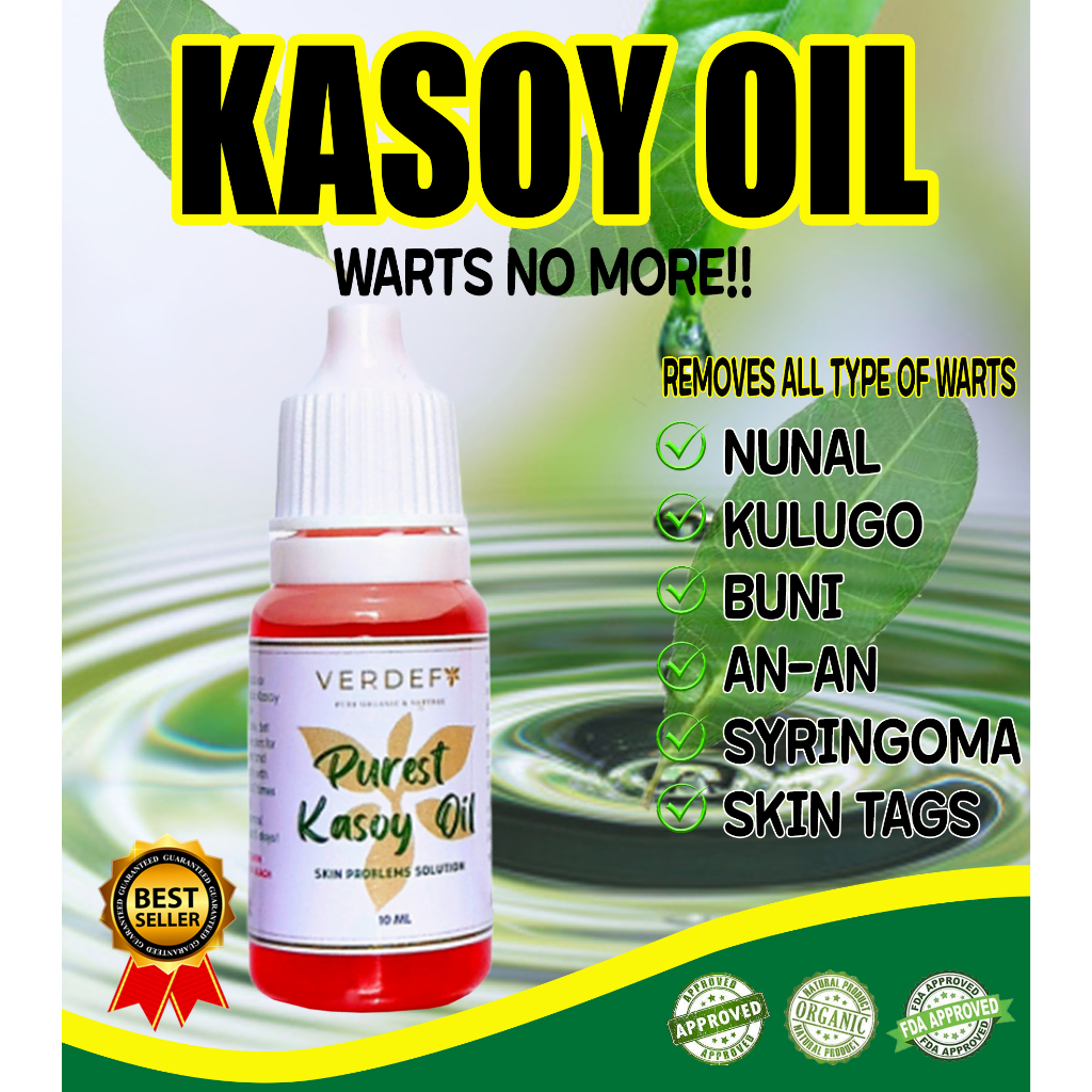 Warts Rover Pure Kasoy Oil Mole Skin Tag Remover Shopee Philippines