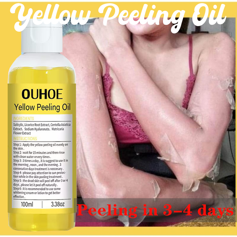 OUHOE Yellow Peeling Oil Lightening Exfoliating Dark Spot Remove