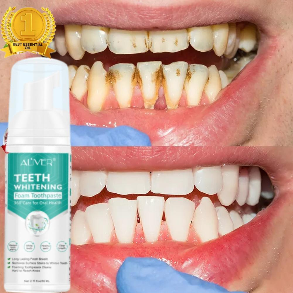 Ml Aliver Teeth Whitening Mousse Toothpaste Remove Tartar Remove