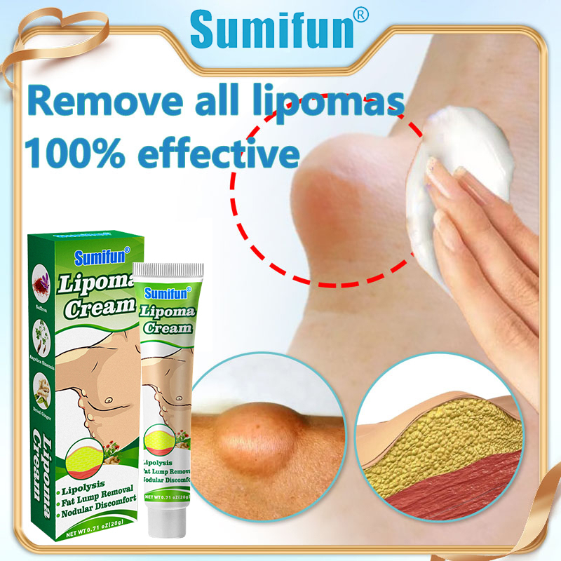 Lipomas Dissolving Cream Lipoma Removal Cream Original Japan Lipoma