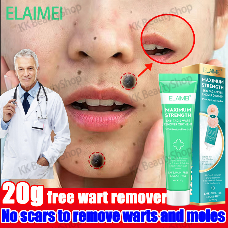 ELAIMEI Warts Remover Original Herbal Warts Remover Ointment Foot Corn