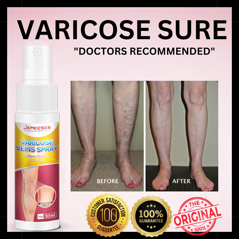 Effective Varicose Vein Spray Original Varicose Veins Effective