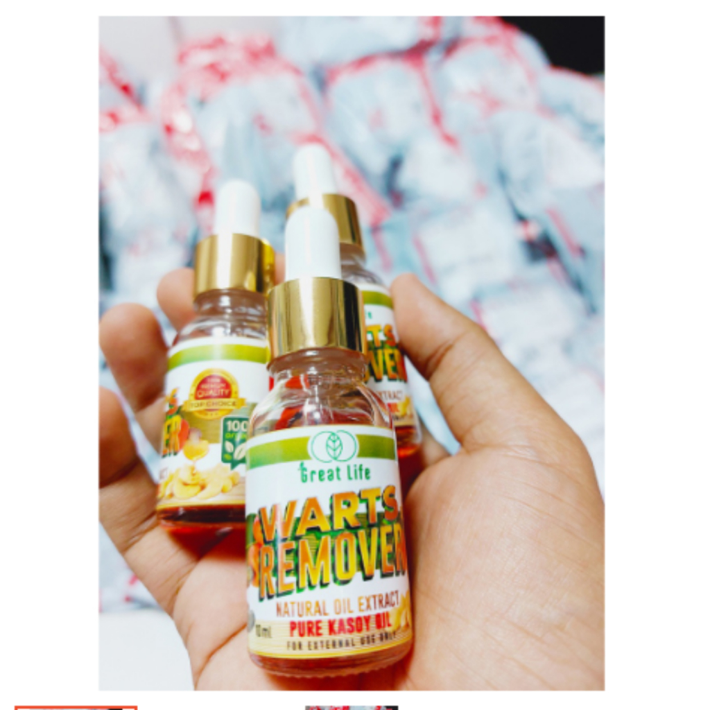 Kasoy Oil Warts Remover Original Effective Skin Tags Shopee Philippines