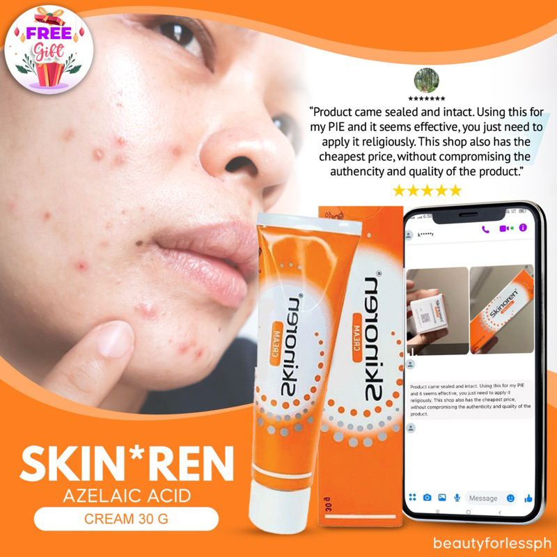 Authentic Skinoren 20 Cream Azelaic Acid For Acne 30g Shopee Philippines