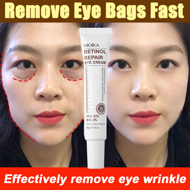 Retinol Eye Cream G Eyebag Remover Fades Wrinkles And Dark Circles