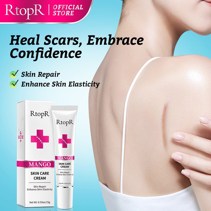 RtopR Scar Removal Cream Acne Scar Treatment Face Cream Body Skin Care