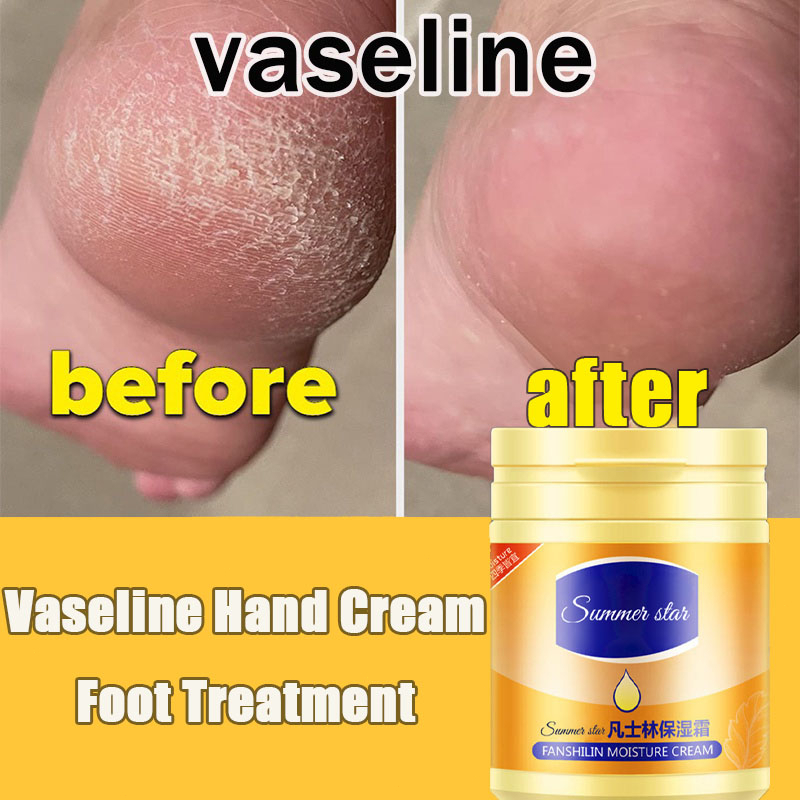 Vaseline Feet Moisturizer Cream Cracked Heel Cream Foot Care Anti Crack