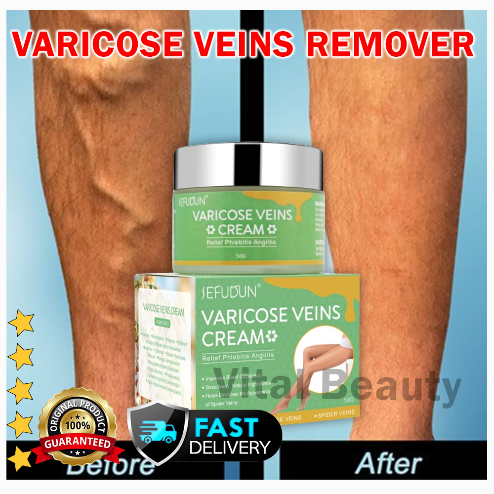 VB SEFUDUN Varicose Vein Remover ORIGINAL Effective Treatment Cream