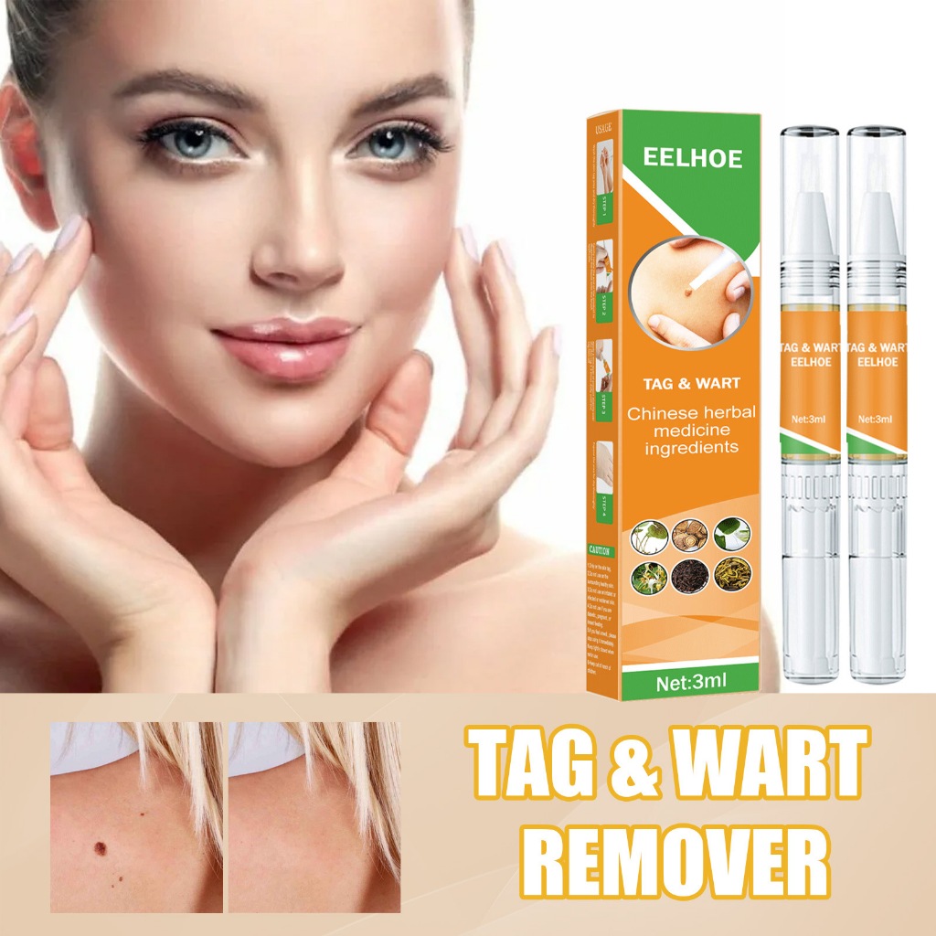 EELHOE Warts Removal Pen Skin Tag Remover Warts Remover Original Mole