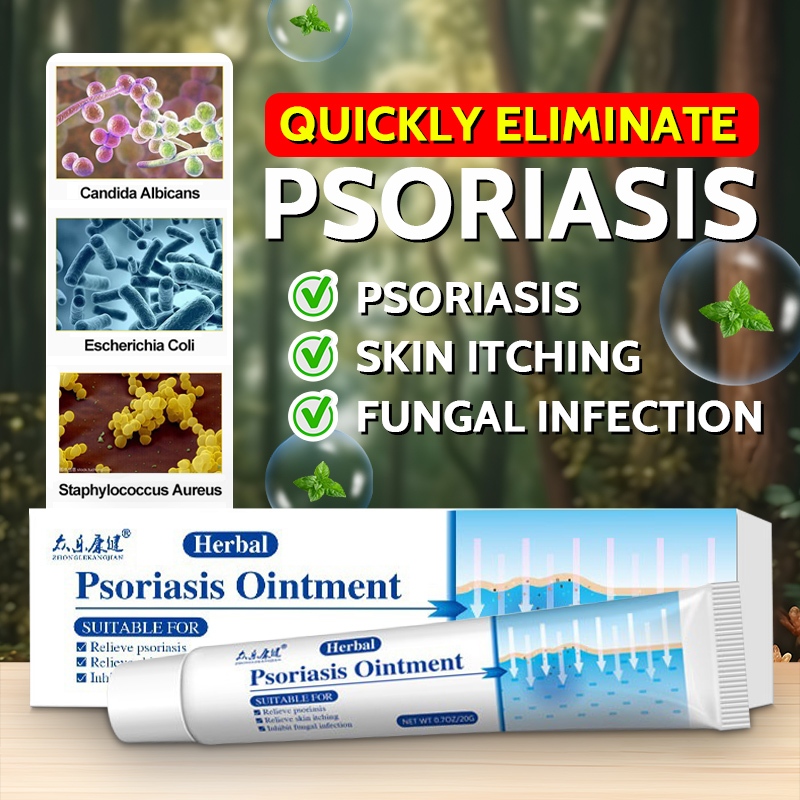 Psoriasis Cream Dermatitis Eczematoid Eczema Pruritus Ointment