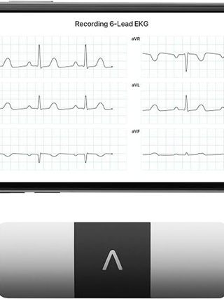 Kardia Mobile 6 Lead Personal EKG MonitorSix Views Of The Heart