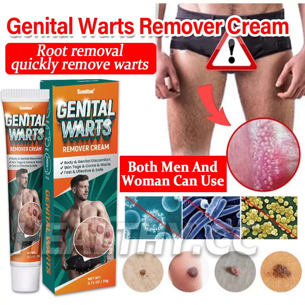 Genital Warts Remover Original Cream Herpes Genital Condyloma Skin Tag