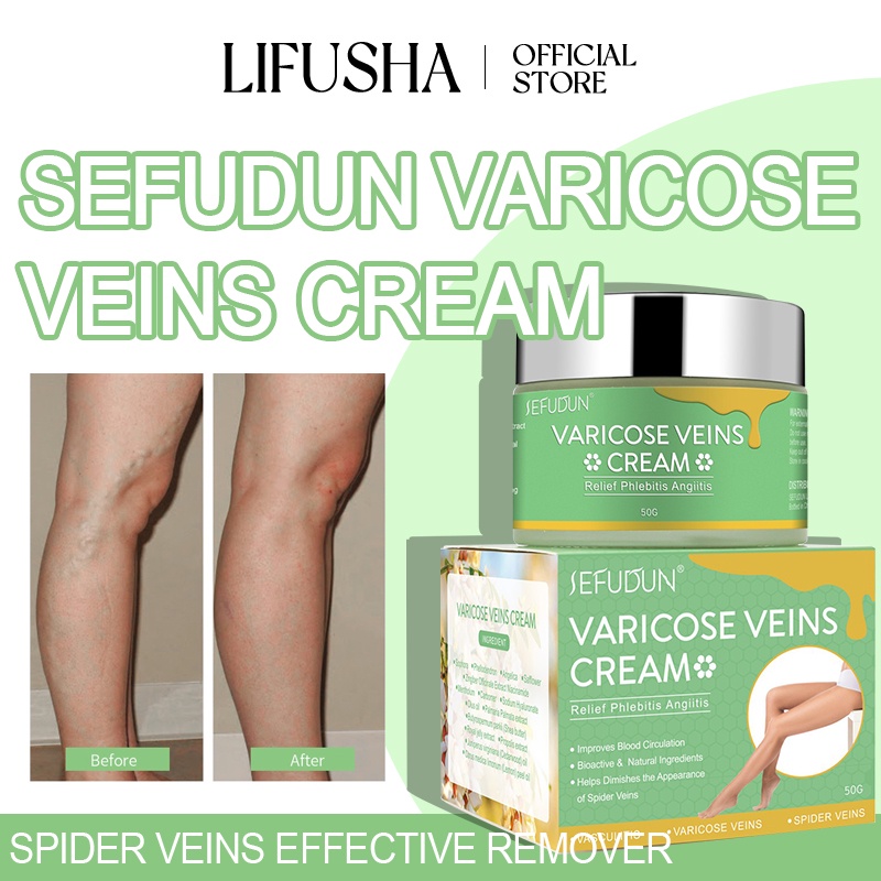 Lifusha Sefudun Varicose Vein Remover Effective Treatment Cream Spider