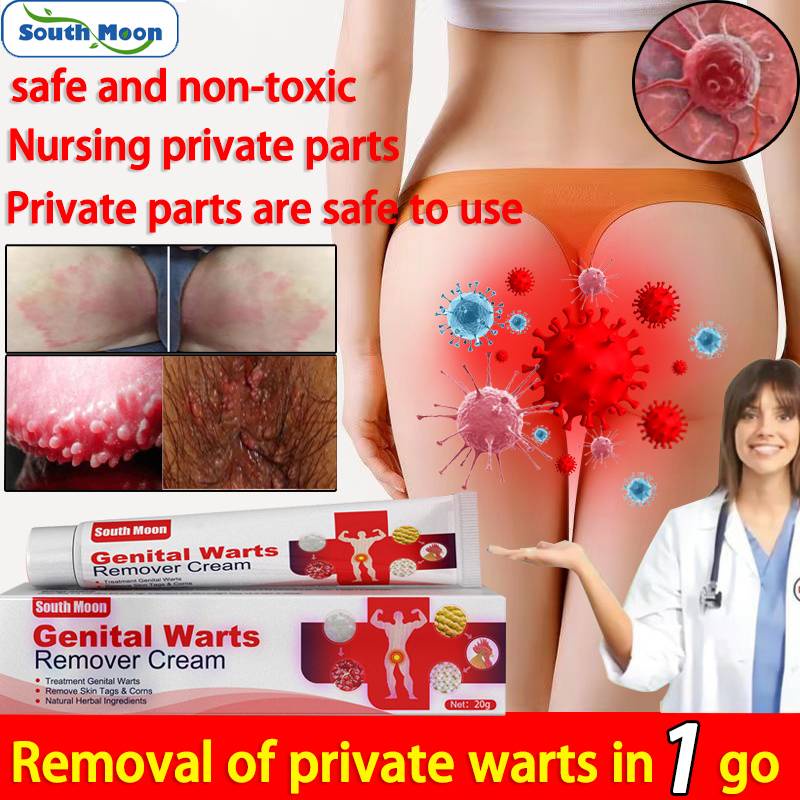 Warts Remover Original Ointment Genital Herpes Genital Condyloma Skin