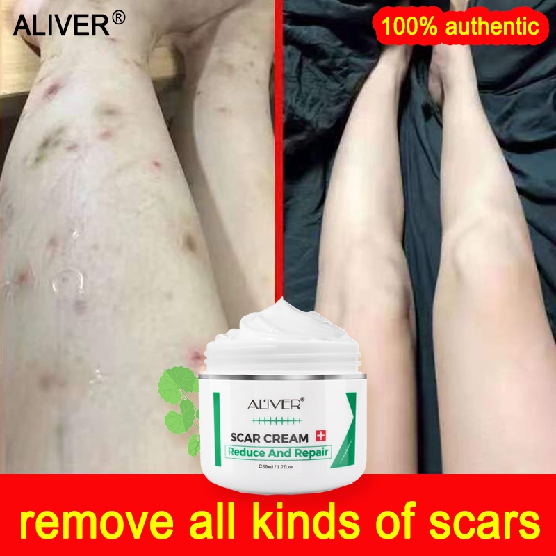 Contractubex Scar Gel Original Scars Removal Cream Surgical Stretch