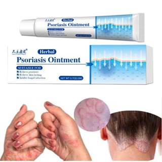 Psoriasis Cream Dermatitis Eczematoid Eczema Pruritus Ointment