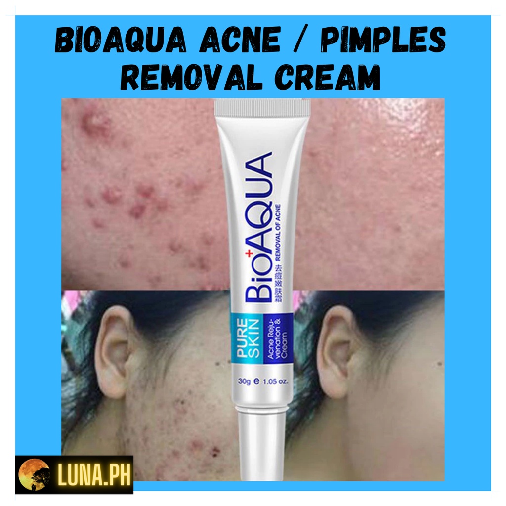 ORIGINAL BIOAQUA ANTI ACNE PIMPLES REMOVAL REJUVENATION CREAM