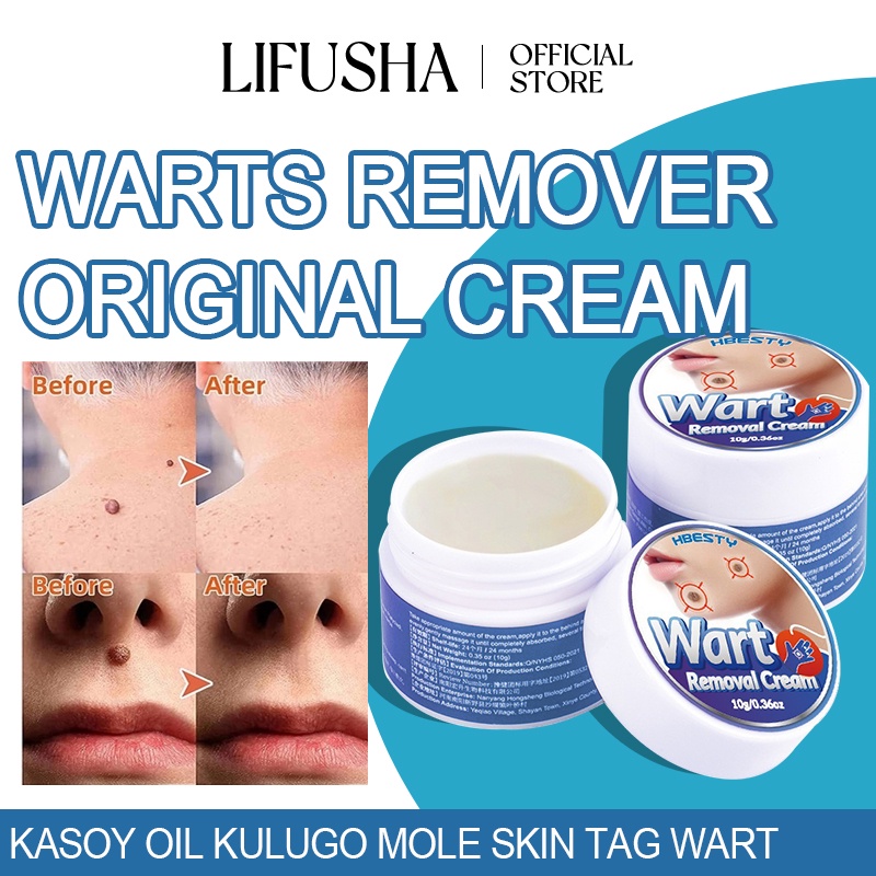 LIFUSHA Warts Remover Original Cream Kasoy Oil Cream Kulugo Mole Skin