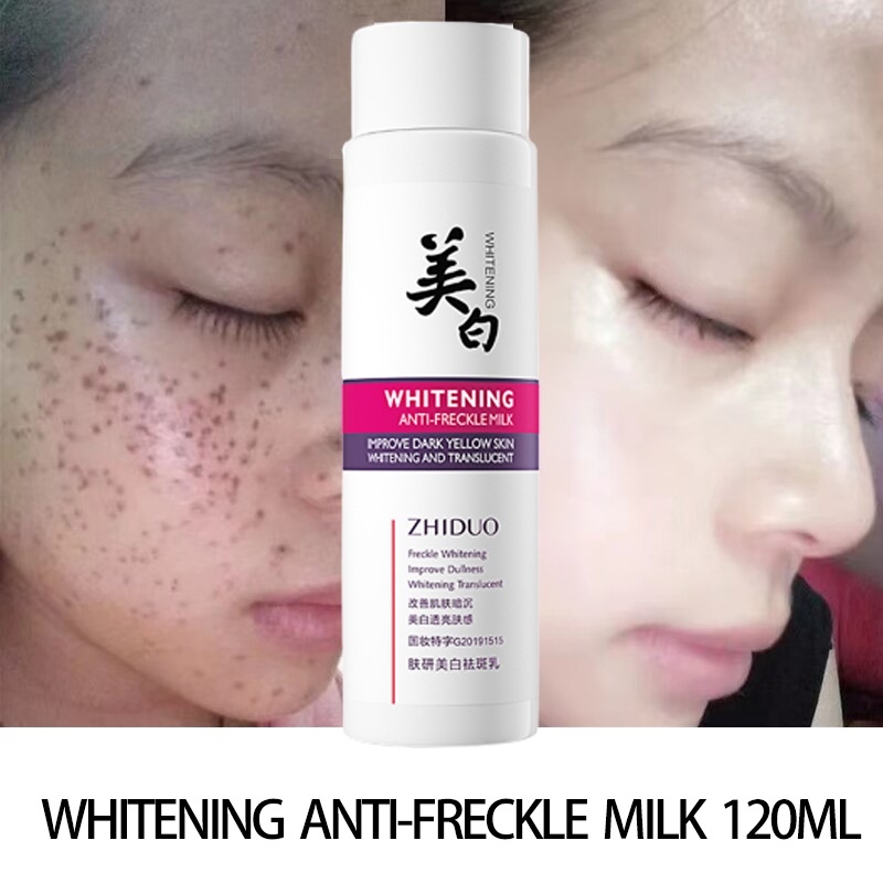 Ml Niacinamide Whitening Freckles Lotion Melasma Cream Pekas Remover